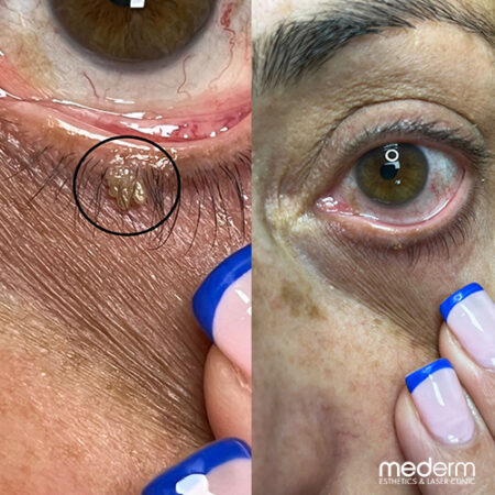 Before & After Photos