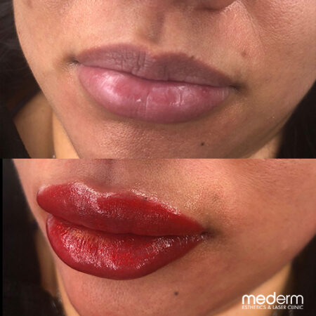 Lip Blush