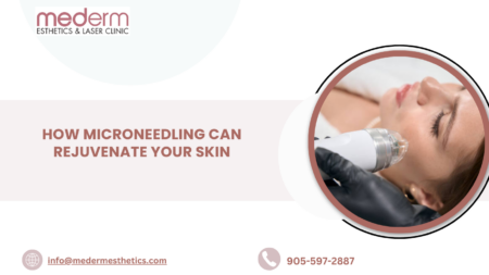 Microneedling in Vaughan