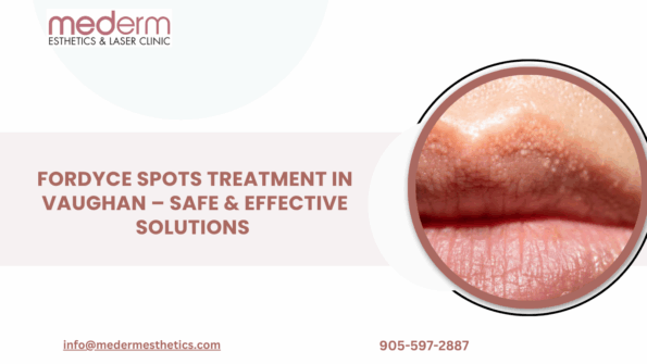 Fordyce Spots Treatment in Vaughan