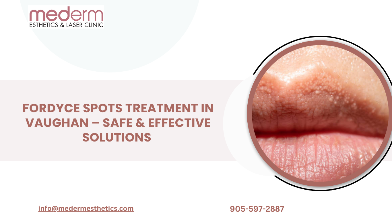 Fordyce Spots Treatment in Vaughan