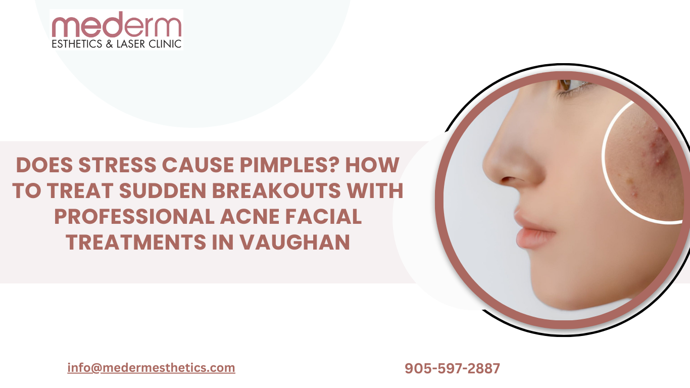 Acne Facial Treatment in Vaughan