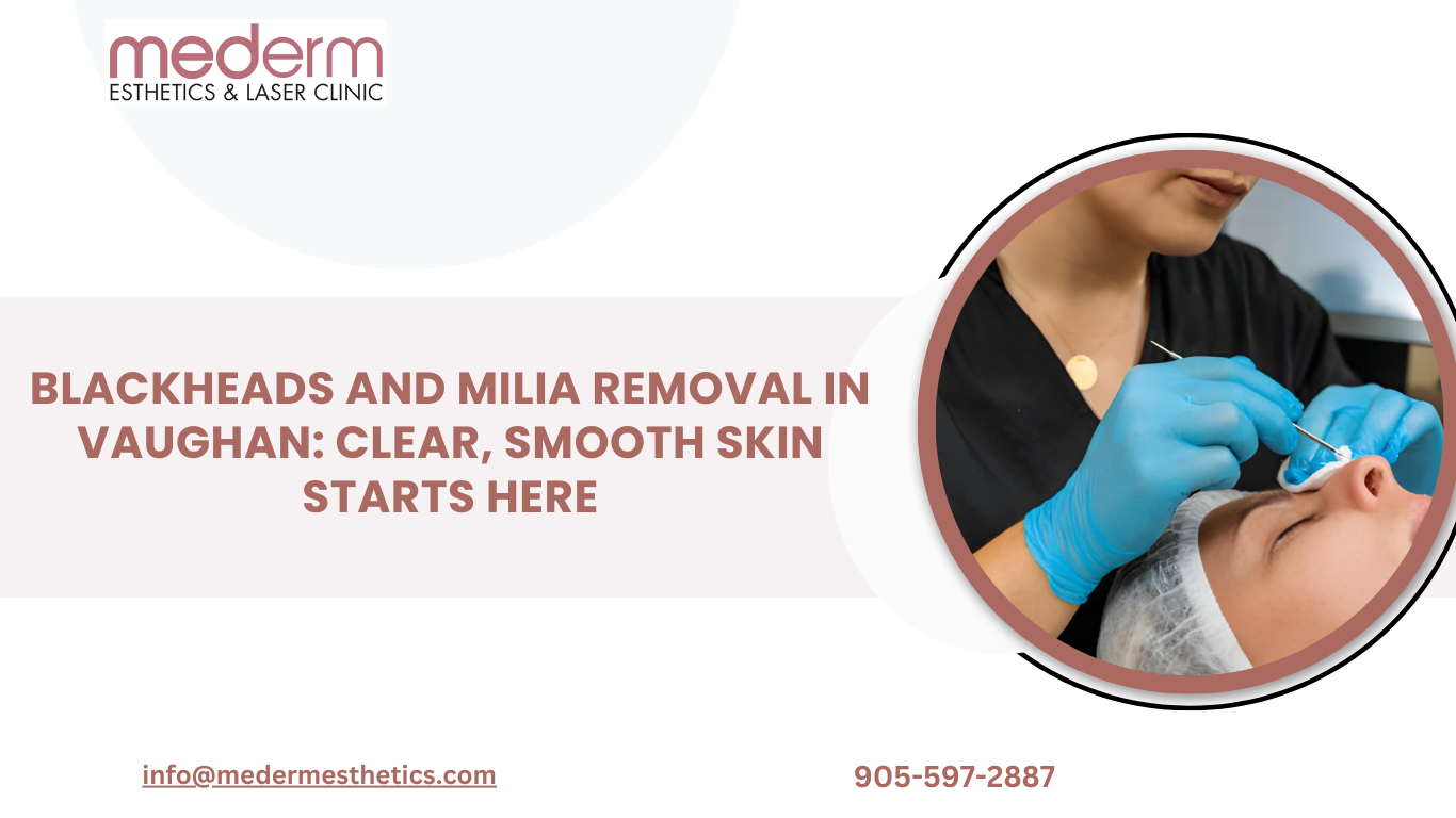 Blackhead and Milia Removal in Vaughan