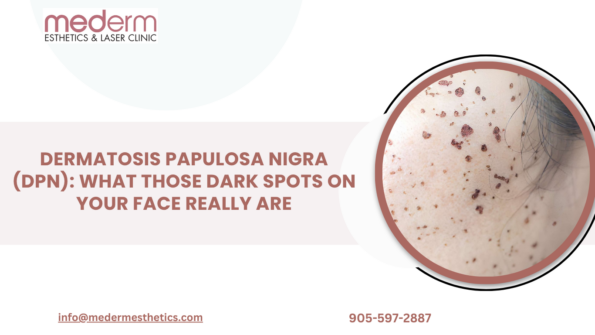 Dermatosis Papulosa Nigra (DPN) in Vaughan